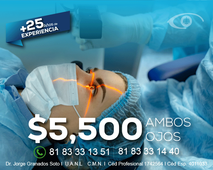 Cirugía lasik servicios